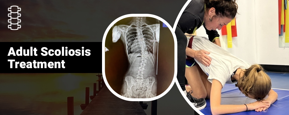 Take Charge of Your Spinal Health with the Right Adult Scoliosis Treatment