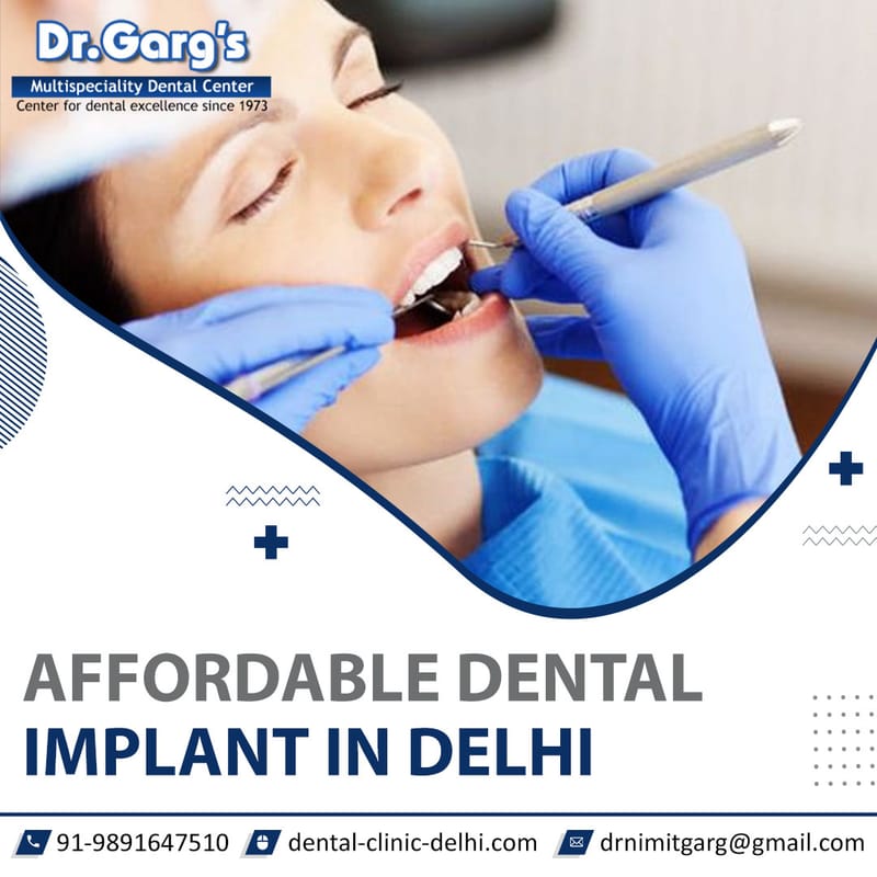 Restore Your Smile with Dental Crowns at Dr. Garg’s Multispeciality Dental Center in Delhi