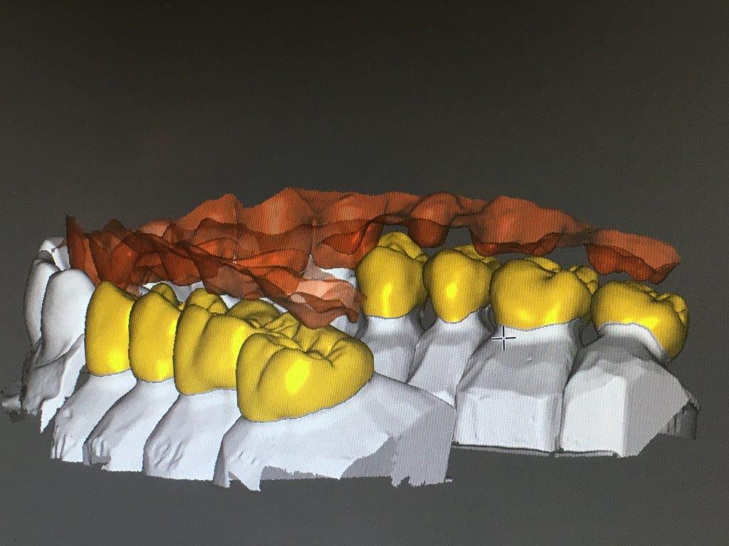 CAD CAM - Roser & Krehl Zahntechnik GmbH