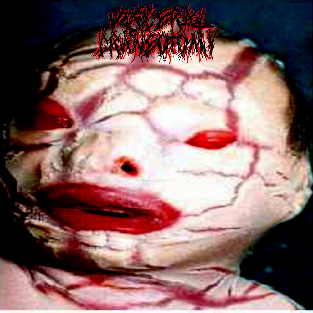 SPLIT COVER VISCERAL CRANEOTOMY/REPULSION MAGNETICA(DIFFERENT COVERS)