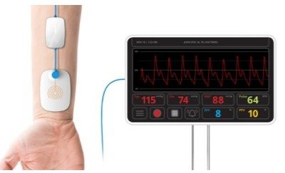 Noninvasive hemodynamic monitoring solution based on sensors and algorithm