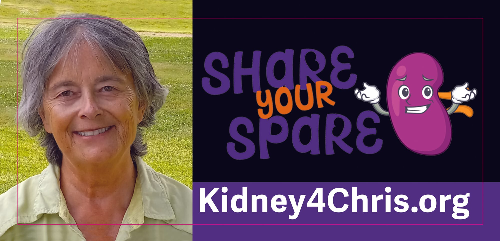 Kidney4Chris.org Yard Sign