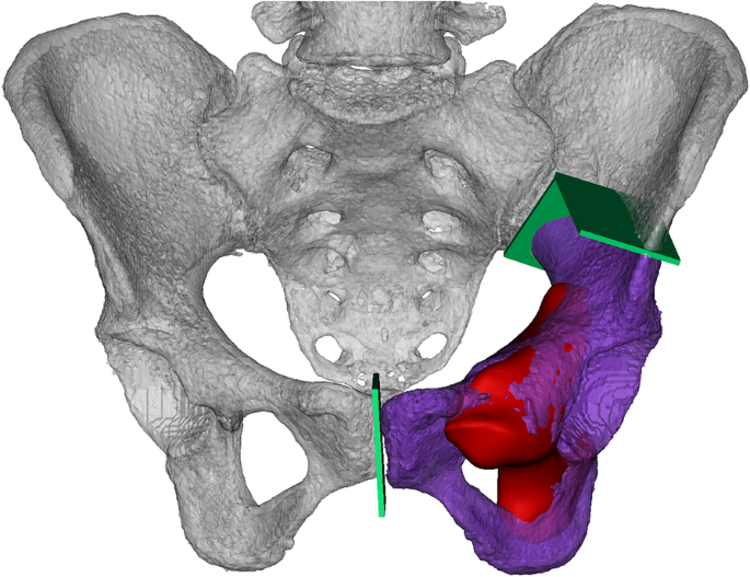 Orthopedic Surgery