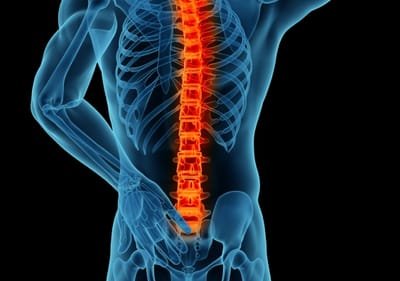 Strategies that are Used When You Want to Take a Spinal Surgery image