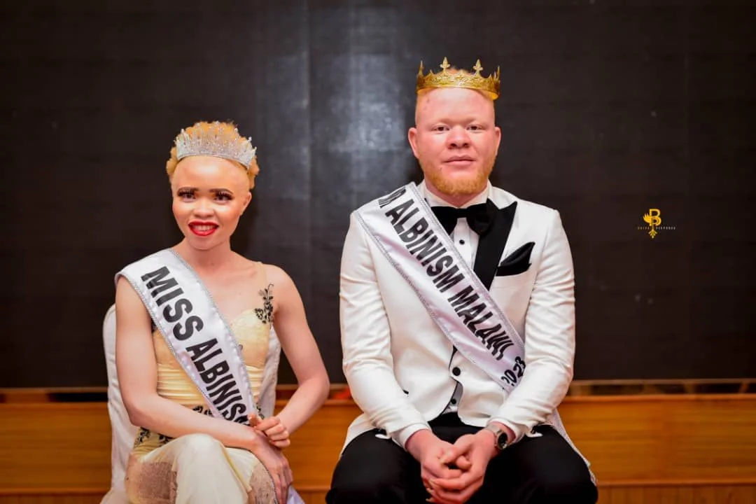 MR, & MISS ALBINISM AVAILED