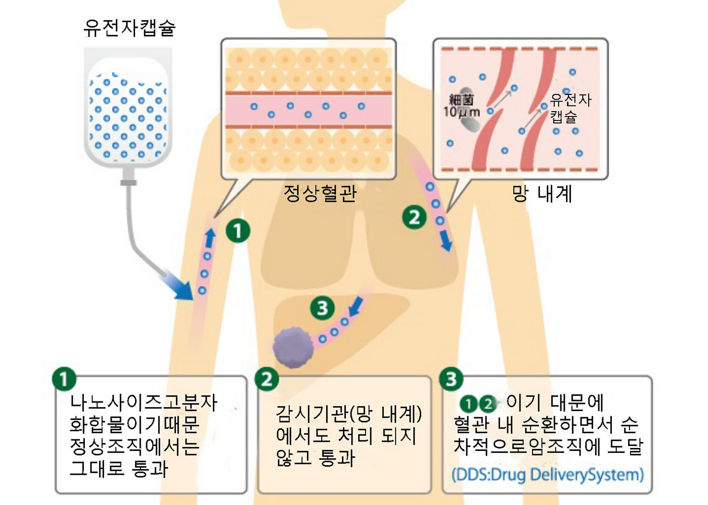 DDS（Drug Delivery System） - 1004