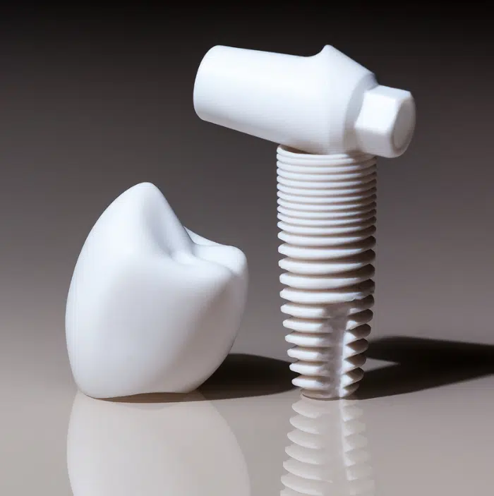 Custom Abutments and Crowns