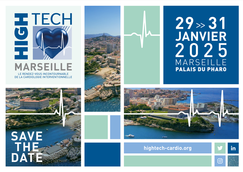 High-Tech Cardio 2025 - AlchiMedics