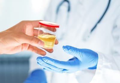 The Benefits of Pre-Employment Drug Testing image