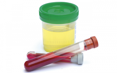 Things You Need To Understand Do Concerning The Drug Tests image